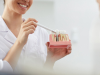avantages-des-implants-courts-dentiste-villepinte