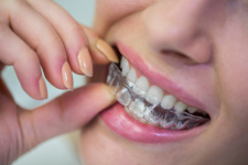 Les particularités des gouttières orthodontiques destinées aux adolescents dentiste Villepinte