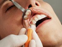 Extraction-implantation Dentiste à Villepinte